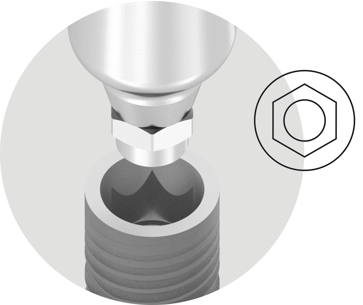 BIONIKA Eco Implant System- connection
