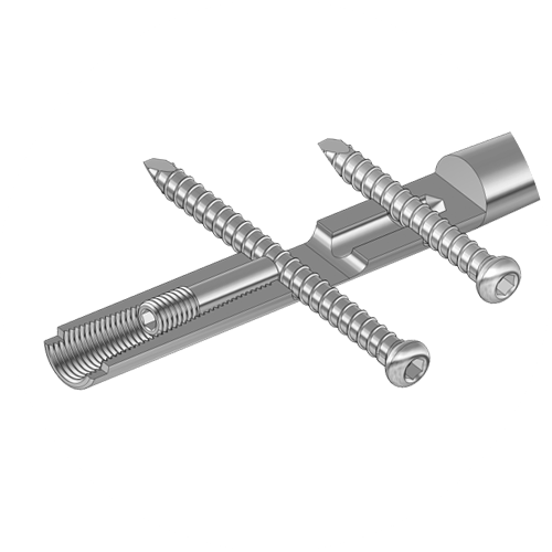 The characteristics of the BIONIKA BFN Femur intramedullary nail- The proximal end of the femur nail