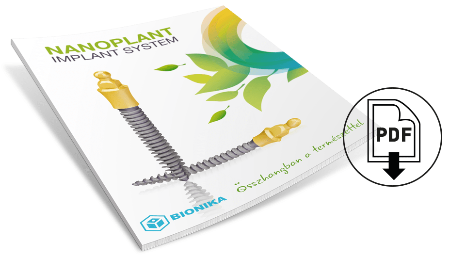 You can download the Nanoplant implant system catalouge, in pdf format!