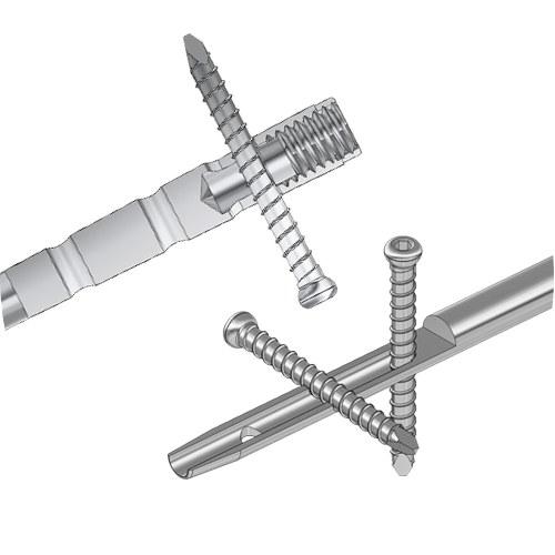 Characteristics of BHN Humerus intramedullary nail