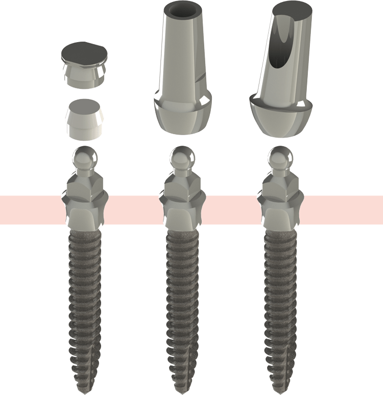 The Nanoplant implants are available with anatomical head abutments as well.