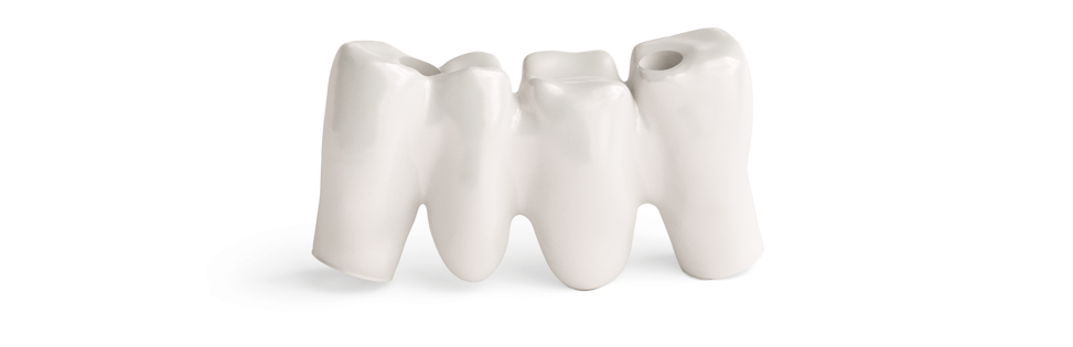 Zirconium tooth framework