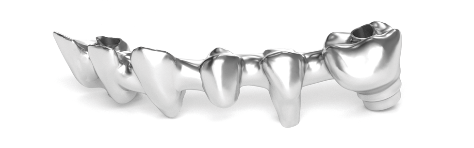 Example of a Co-Cr prosthesis.