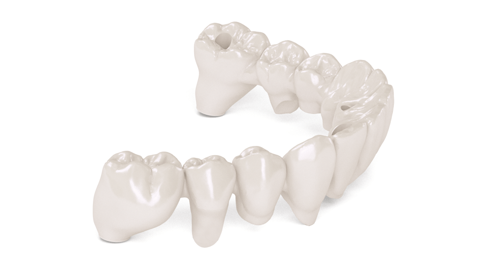 tooth framework