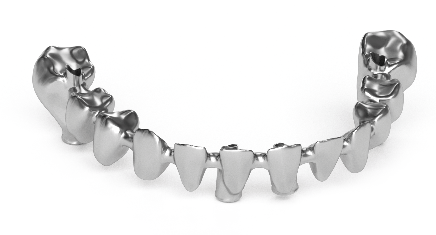 titanium tooth framework