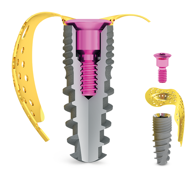 3d-builder Speedy implantátum széles skálájú hosszméretben kapható.