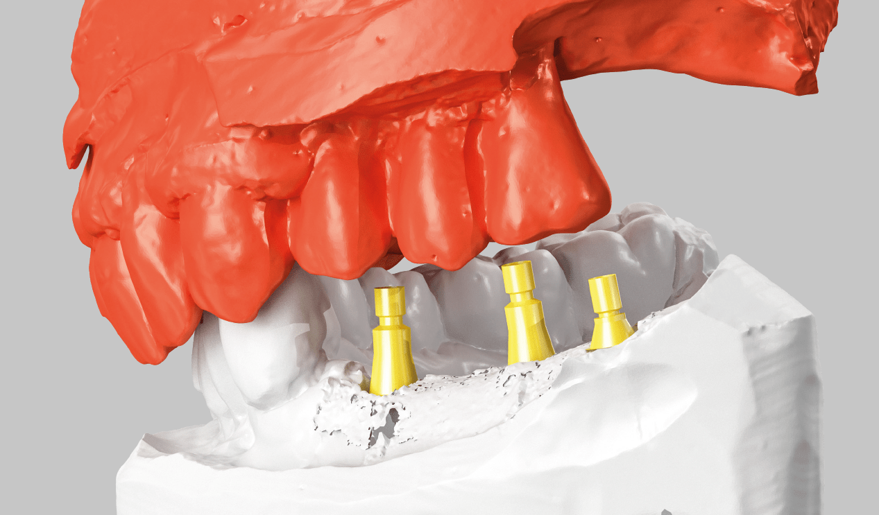 cad-cam-hogyan-keszult-3