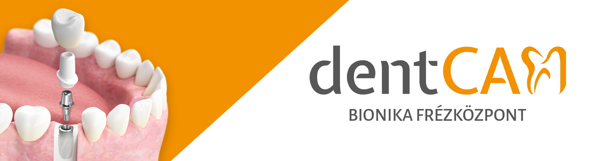 dentcam