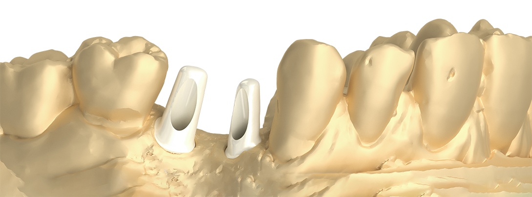 Miswak