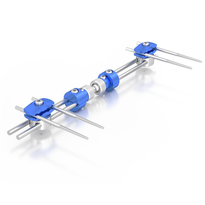 fixateurok-2-composite