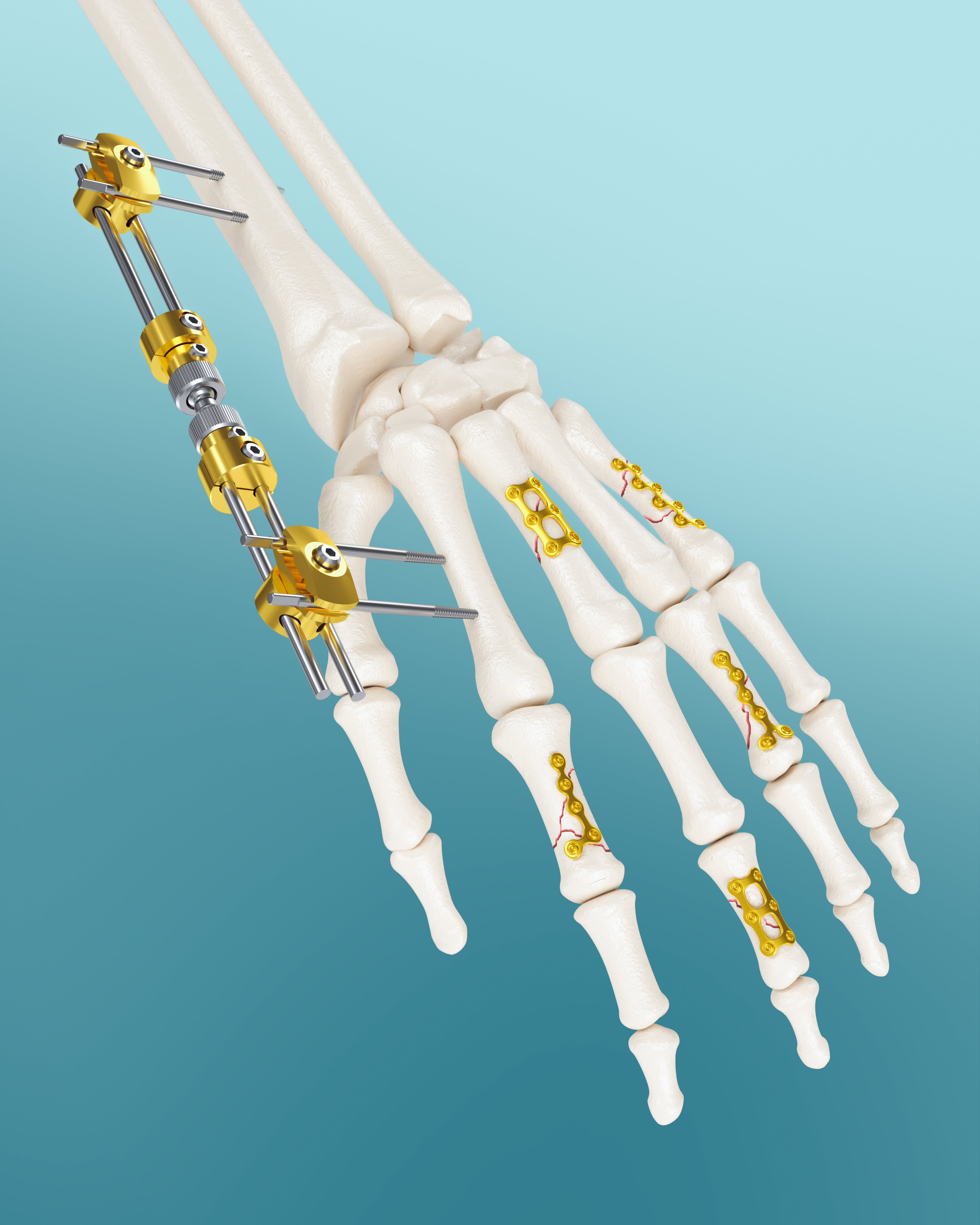 implantshop bg