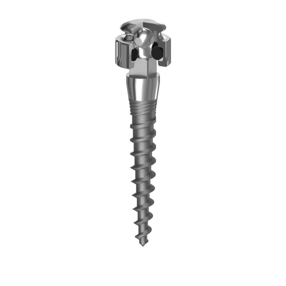 mdi-implantatum-vagottfeju