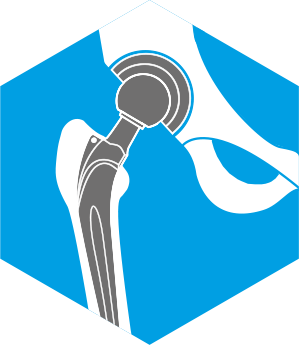 Ortopédiai termékek, pl. csípőprotézisek.