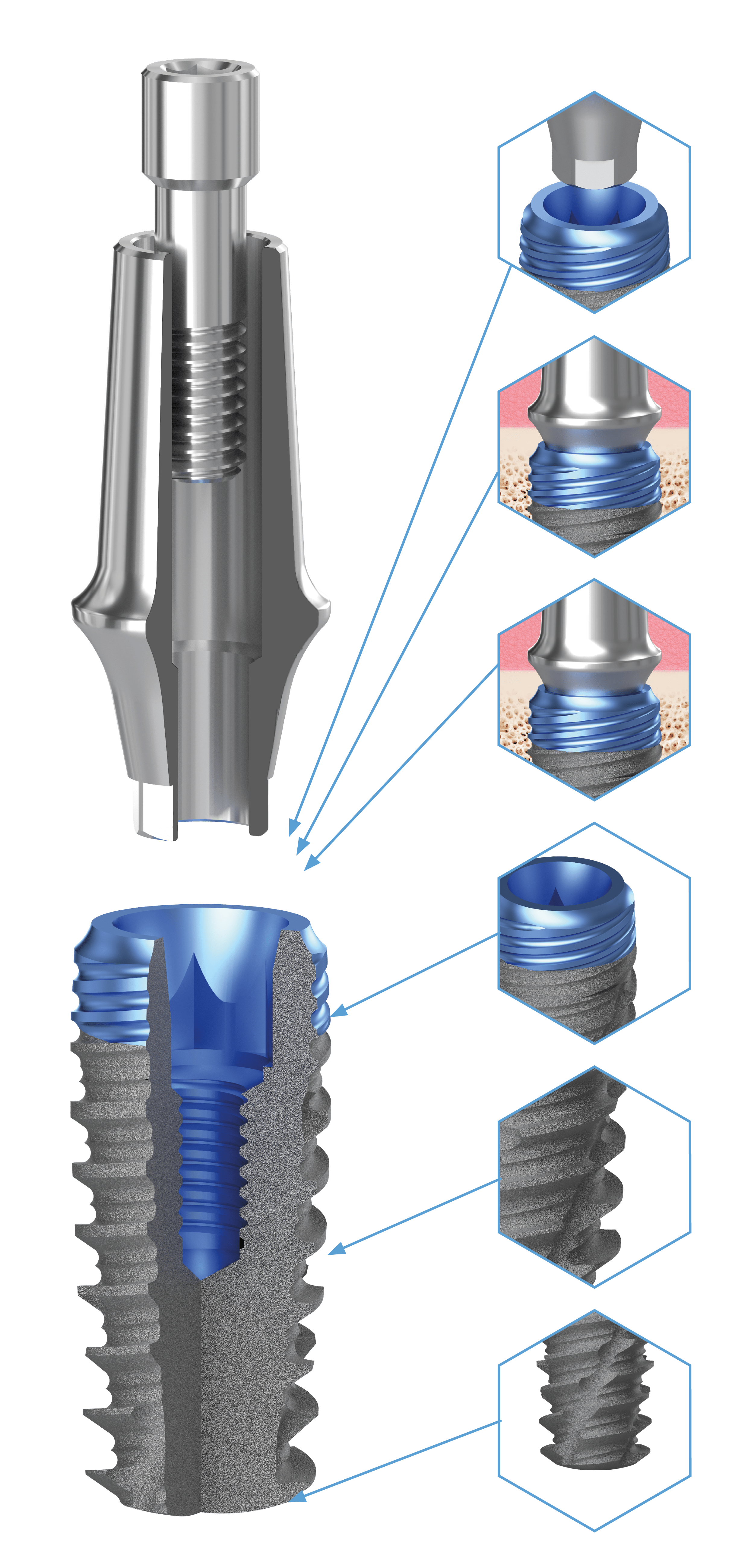 BioLevel
