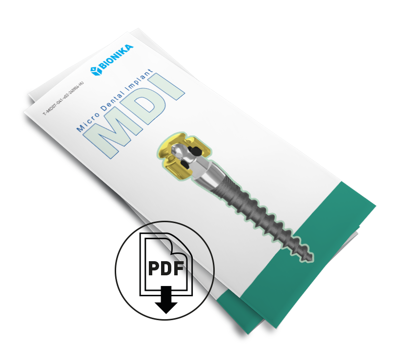 Innen letölthető az MDI implantációs rendszer katalógusa, pdf formátumban.